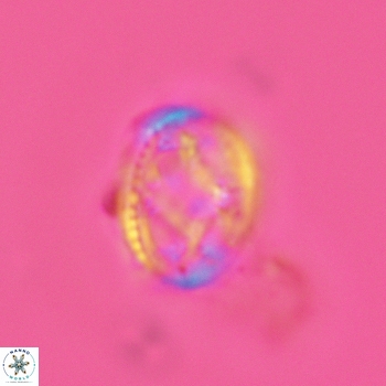 Axopodorhabdus dietzmannii 3624