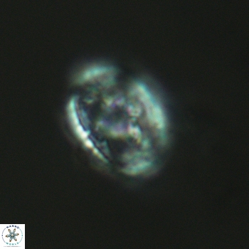 Axopodorhabdus dietzmannii 3625