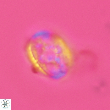 Axopodorhabdus dietzmannii 3626