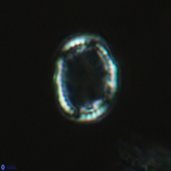 Axopodorhabdus dietzmannii 3627