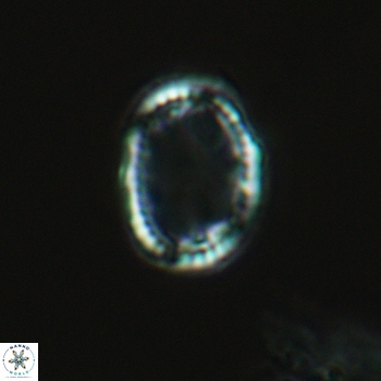 Axopodorhabdus dietzmannii 3627