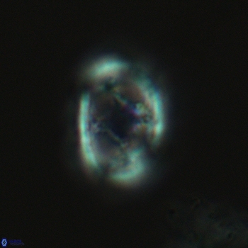 Axopodorhabdus dietzmannii 3628