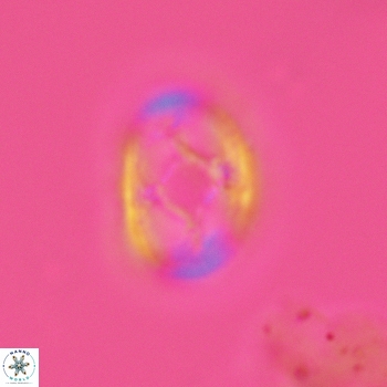 Axopodorhabdus dietzmannii 3629