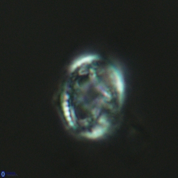 Axopodorhabdus dietzmannii 3623