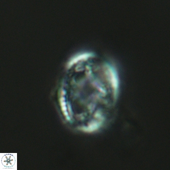 Axopodorhabdus dietzmannii 3623