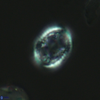 Axopodorhabdus dietzmannii 3639