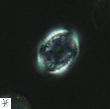 Axopodorhabdus dietzmannii 3639