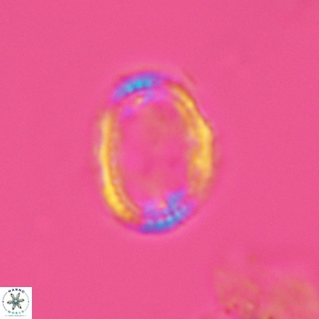 Axopodorhabdus dietzmannii 3630