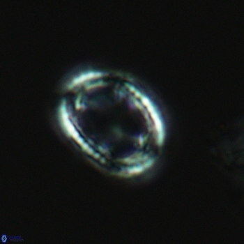 Axopodorhabdus dietzmannii 3631