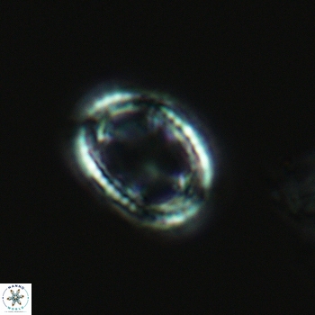 Axopodorhabdus dietzmannii 3631