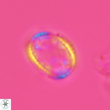 Axopodorhabdus dietzmannii 3632
