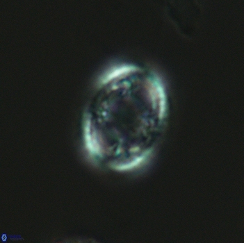 Axopodorhabdus dietzmannii 3644