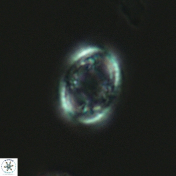Axopodorhabdus dietzmannii 3644