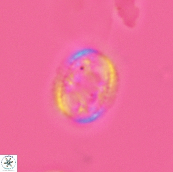 Axopodorhabdus dietzmannii 3645