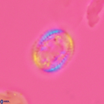 Axopodorhabdus dietzmannii 3640