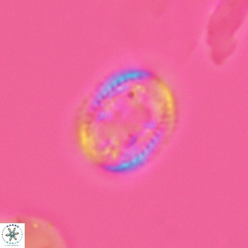 Axopodorhabdus dietzmannii 3640