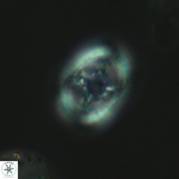 Axopodorhabdus dietzmannii 3641