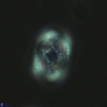 Axopodorhabdus dietzmannii 3642