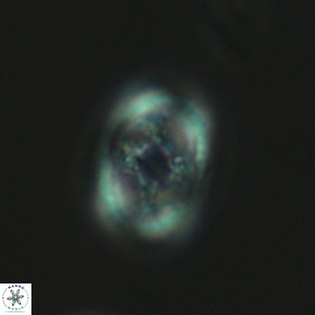 Axopodorhabdus dietzmannii 3642