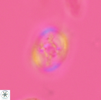 Axopodorhabdus dietzmannii 3643