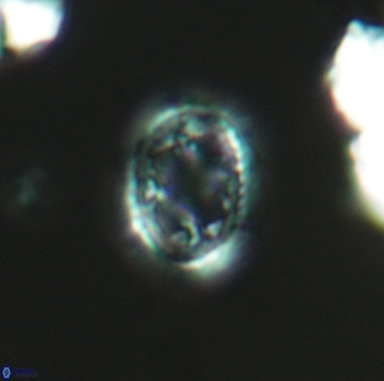 Axopodorhabdus dietzmannii 3654