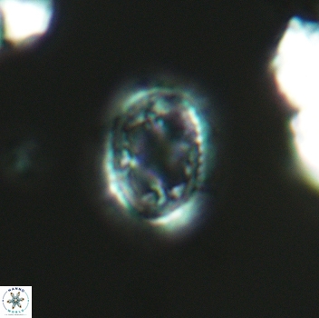 Axopodorhabdus dietzmannii 3654