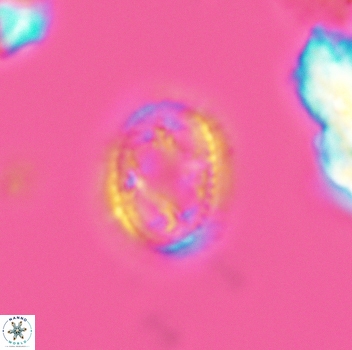 Axopodorhabdus dietzmannii 3655