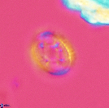 Axopodorhabdus dietzmannii 3656