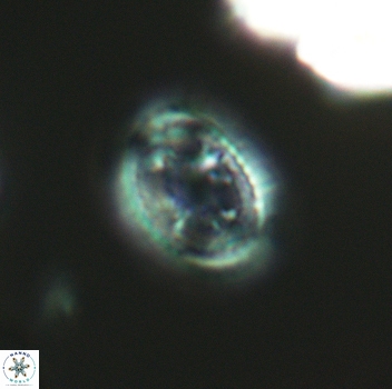Axopodorhabdus dietzmannii 3657