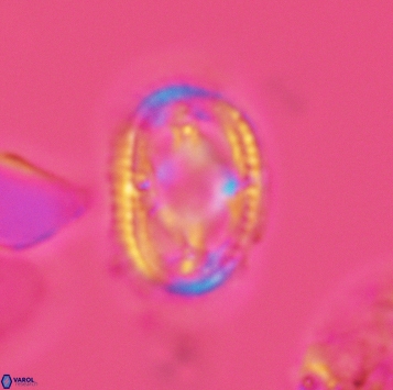 Axopodorhabdus dietzmannii 3725