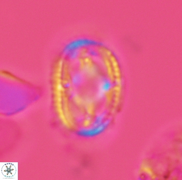 Axopodorhabdus dietzmannii 3725