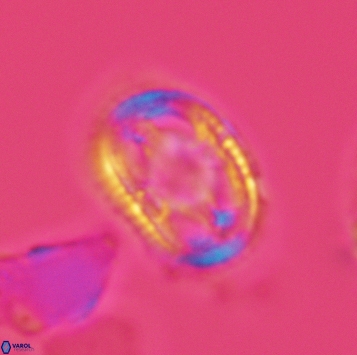 Axopodorhabdus dietzmannii 3726