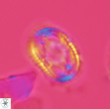 Axopodorhabdus dietzmannii 3726