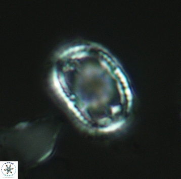 Axopodorhabdus dietzmannii 3727