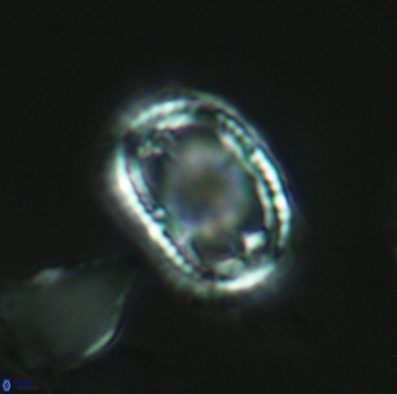 Axopodorhabdus dietzmannii 3727