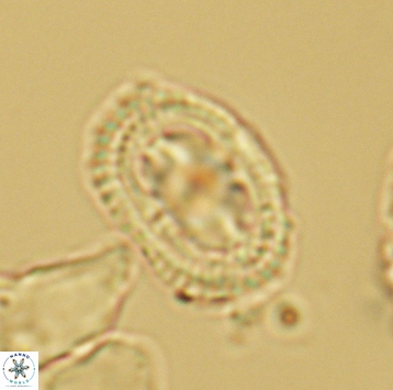 Axopodorhabdus dietzmannii 3728