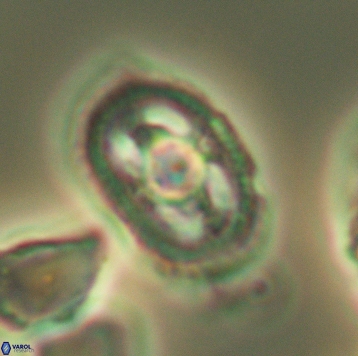 Axopodorhabdus dietzmannii 3729