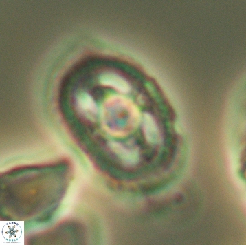 Axopodorhabdus dietzmannii 3729