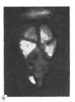 Braarudosphaera batilliformis 13172