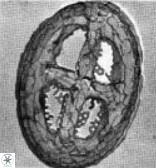 Broinsonia ethmoquadrata 14770