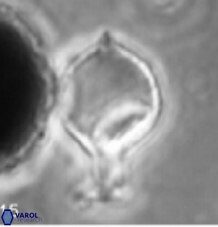 B globosus2