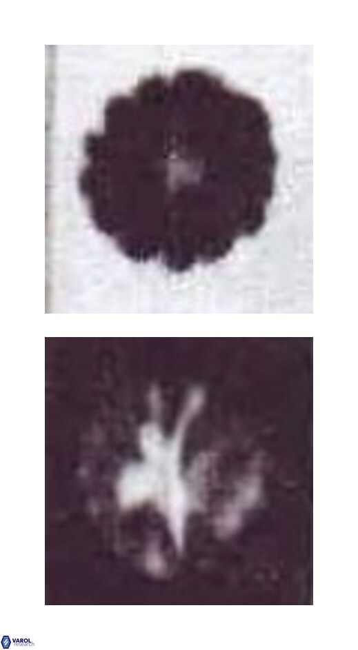 Biscutum testudinarium 4741