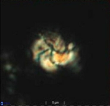 Braarudosphaera turbinea 6522