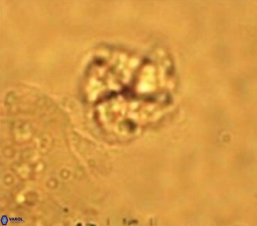 Braarudosphaera turbinea 6522