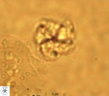 Braarudosphaera turbinea 6522