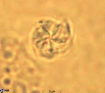 Braarudosphaera turbinea 6522