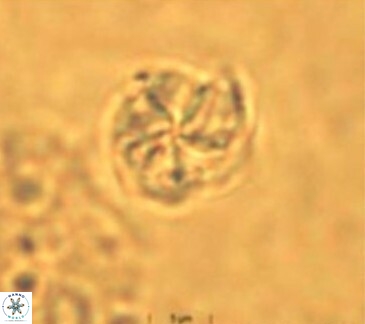 Braarudosphaera turbinea 6522