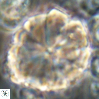 Biantholithus sparsus 21651