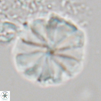 Biantholithus sparsus 21930