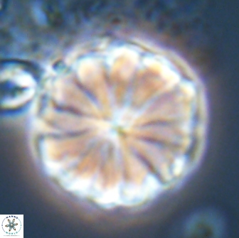 Biantholithus sparsus 21931